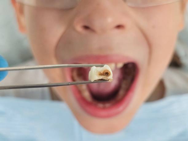 Best Emergency Dental Care for Trauma or Injury in Zion, PA